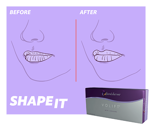 ShapeIT