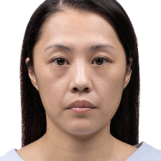 BeforeTreatement-Product